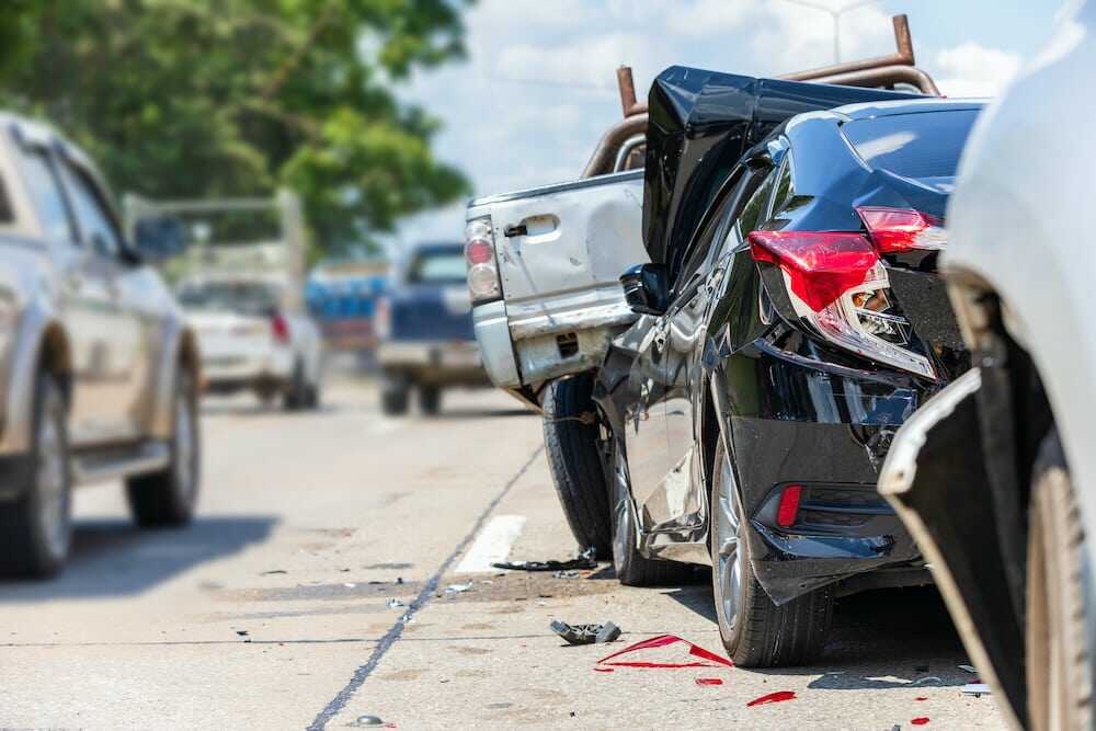 When To Hire A Car Accident Attorney In Orange County